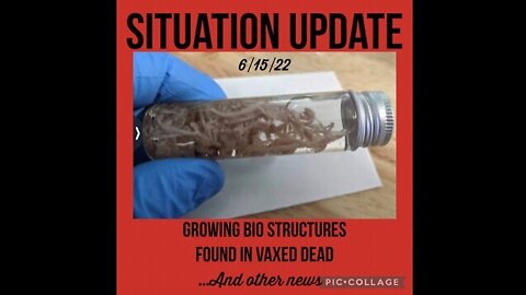 Situation Update 6/15/22: Growing Bio-Structures Found In Veins Of Vaxed Dead By Embalmers! Black Swan Event!