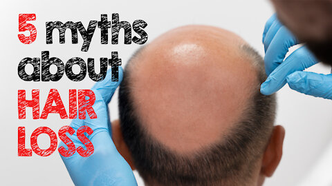 5 Myths About Hair Loss