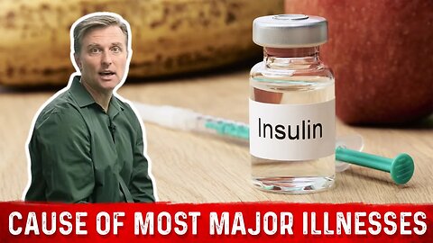 Insulin is the Cause of Most Major Illnesses – Dr. Berg on High Insulin Levels