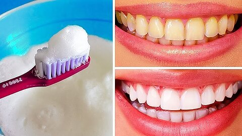 DIY Teeth Whitening at Home in 2 minutes