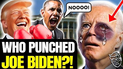 BIDEN APPEARS IN PUBLIC WITH MASSIVE MYSTERIOUS BLACK BRUISE ON FACE! ELDER ABUSE? ANOTHER COLLAPSE?