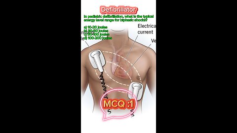 Defibrillator machine in icu #defibrillator #mcqs #pharmacologynotes #MedicalQuiz #mcqs #quiz