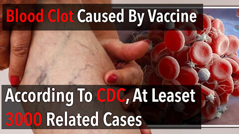 Blood Clot Caused By Vaccine - According to CDC, At Least 3000 Cases And CDC Doesn't Do Verification