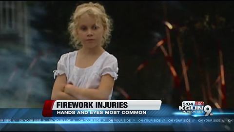 Trauma surgeon talks firework injuries