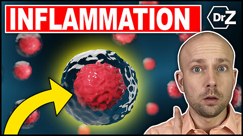 #1 Cause of Inflammation Tormenting You - Anti Inflammatory Diet