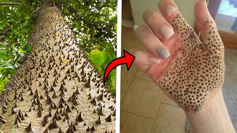 Top 10 Most Dangerous Trees You Should NEVER Touch