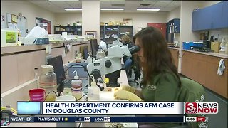 Health Department confirms AFM case in Douglas County