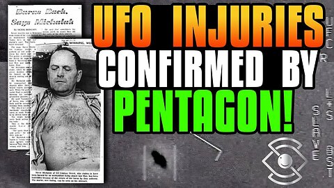 The Pentagon Says Its Real... UFO Injuries