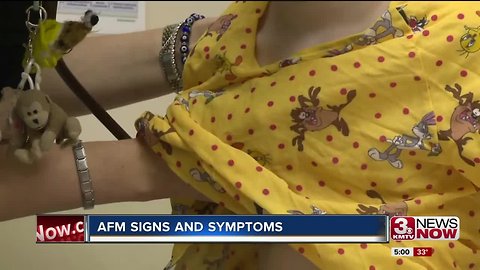 Signs and symptoms to be on the lookout for when it comes to AFM