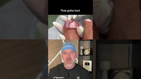 Satisfying Toenail Extraction 🤤 #shorts