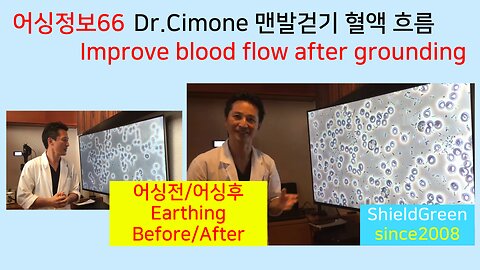 어싱정보66-맨발걷기후 혈액흐름 개선-Cimone박사 실험.Improving blood flow after barefoot walking