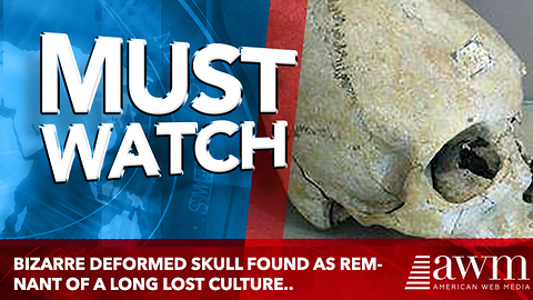 Bizarre deformed skull found as remnant of a Long Lost culture..