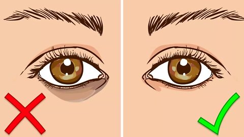 How To Get Rid Of Dark Circles Under Your Eyes