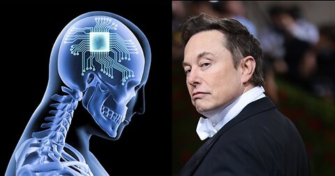 BRAIN CHIPElon Musk To Start BRAIN CHIP HUMAN Trials LOL