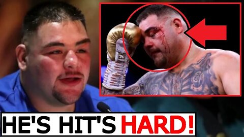 Anthony Joshua BEATS Tyson Fury!👀"He is the HARDEST PUNCHER I've ever faced" [2024] BOXING INTERVIEW