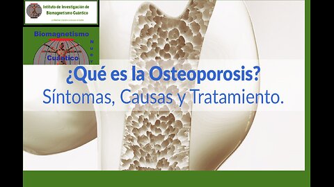 Tratamiento Integral de la Osteoporosis: Biodescodificación y Biomagnetismo