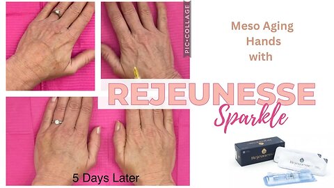 Rejneeusse Sparkle - Plump Aging Hands Long-Lasting