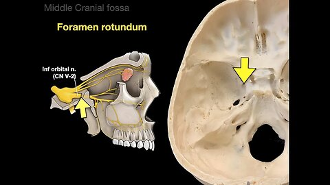 The Skull