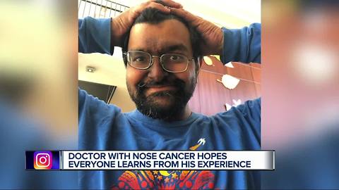 Metro Detroit doctor ignores symptoms he had no idea were signs of rare nose cancer