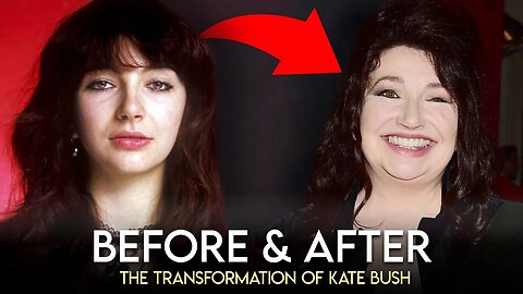 Kate Bush | Before & After | Plastic Surgery Transformation