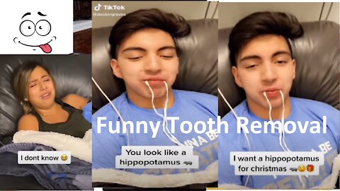 Funniest wisdom teeth removal || Wisdom teeth Removal Tiktok Compilations