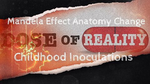 Mandela Effect Personal Anatomy Change ~ Childhood Inoculations