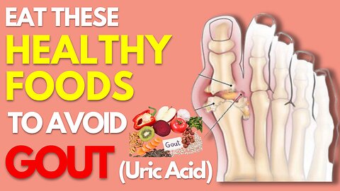 Bring Your Uric Acid Down with These Food Tips