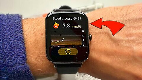 I TRIED A NON-INVASIVE BLOOD SUGAR WATCH. MIRACLE OR SCAM?