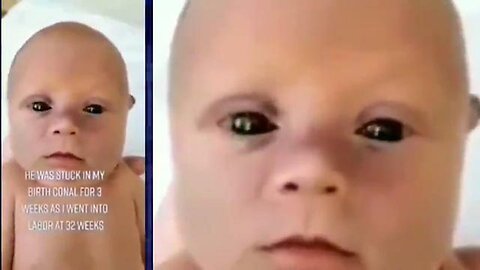 Footage Of Black Eyed Hybrid 'VIRUS' Vaccine 'Pandemic' Babies You Probably Haven't Seen!