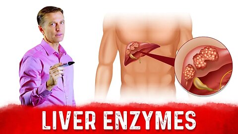 High Liver Enzymes [ALT & AST] – What Do They Mean? – Dr.Berg