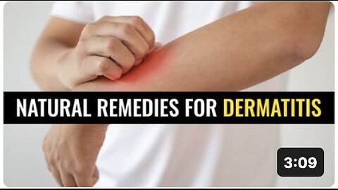 Natural remedies for dermatitis