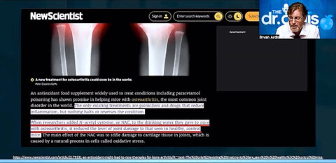 Dr. Bryan Artis on 4 nutrients that help alleviate arthritis. Nicotine patches - near the end