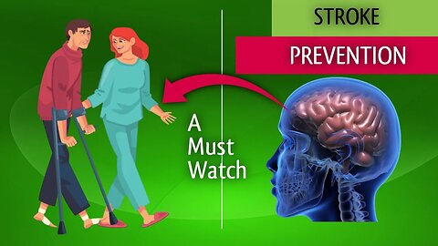 STROKE PREVENTION #knowyournumbers #StayFitStaySafe #StrokeFreeLife #HealthyHeartJourney