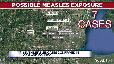 4 additional cases of measles confirmed in Oakland County