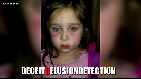 5-year-old white child attacked on school bus ride home by black student