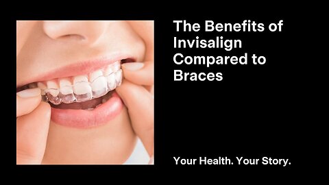 The Benefits of Invisalign Compared to Braces