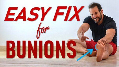 How To Get Rid Of Those BUNIONS