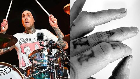 Travis Barker destroyed his finger