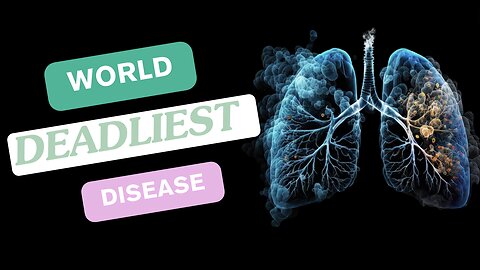 Deadliest Pandemics That Shook the World (TOP 10)