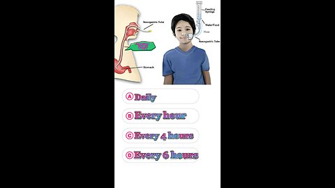 NG tube insertion question answer mcqs #shormcqs #ngtube #disease #pharmacologyexam