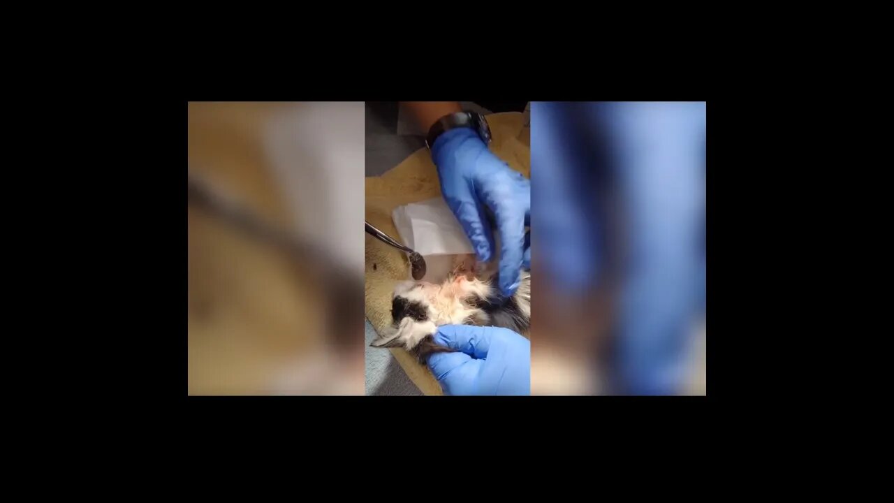 Popping huge blackheads and Pimple Popping Best Pimple Popping Videos