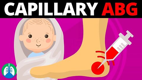 Capillary Blood Gas Sampling (Quick Medical Overview)