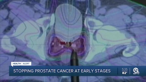 Early detection of prostate cancer critical for treatment, experts say