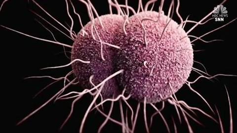 Center for Disease Control and Prevention study finds sharp rise in STDs