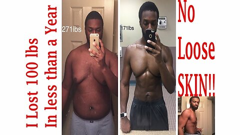 Safely lose 100 lbs in less than a year with NO Loose SKIN