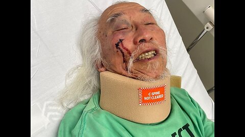 Australia: Police assault elderly man, slamming him to the ground face first.