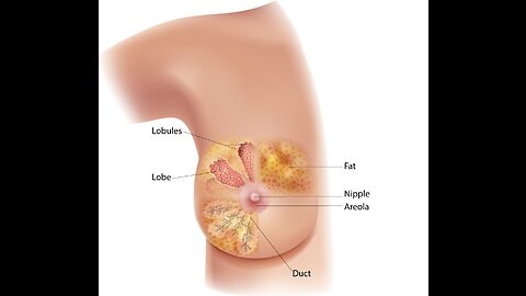 Theratechnologies - Triple Negative Breast Cancer technology