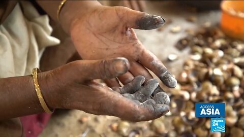 Beware Cashews Have a Harmful Effect of Hands