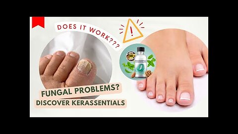 KERASSENTIALS [ [⚠️BEWARE!!!⚠️]] KERASSENTIALS REVIEW 2023 – Does It Work?