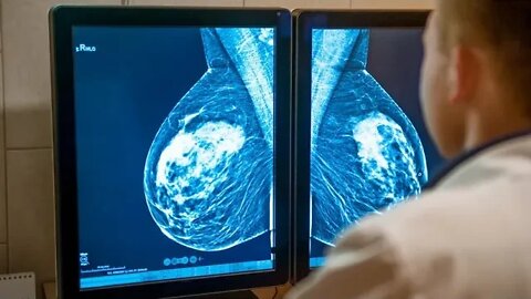 Study Provides New Estimates of Breast Cancer Risks Associated with HRT